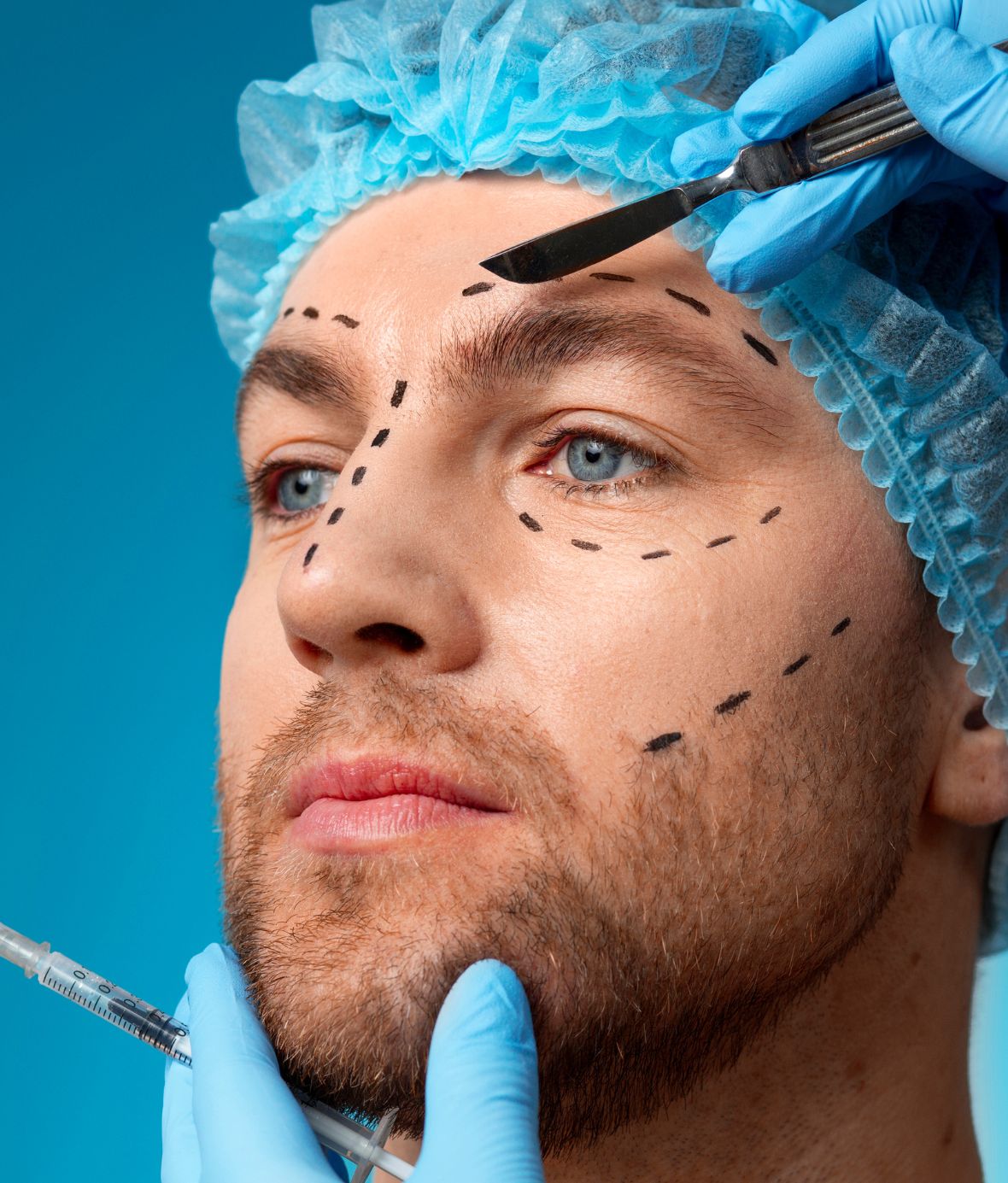 blepharoplasty eyelid surgery